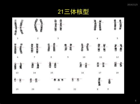 Ppt 主讲人：郭奕斌 中山医学院医学遗传学教研室 Powerpoint Presentation Id6131138