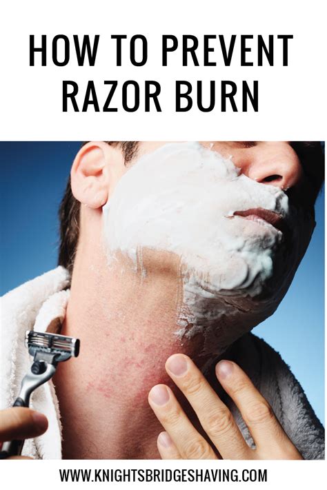 How To Treat A Razor Burn