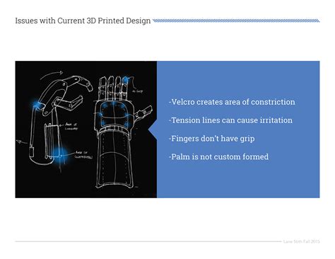 Prosthesis Design on Behance