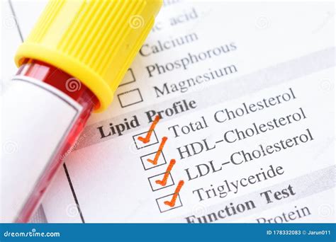 Blood Sample Tube For Lipid Profile Test Stock Image Image Of