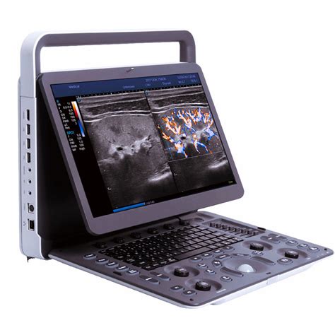 China 2023 Sonoscape E2 E2 Pro Portable Color Doppler System 3D 4D 5D