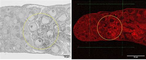 Sem To Tem Technique For Higher Resolution Imaging Cambridge