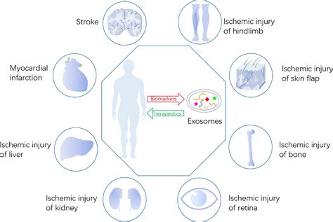 The Potential Role Of Exosomes In The Diagnosis And Therapy Of Ischemic