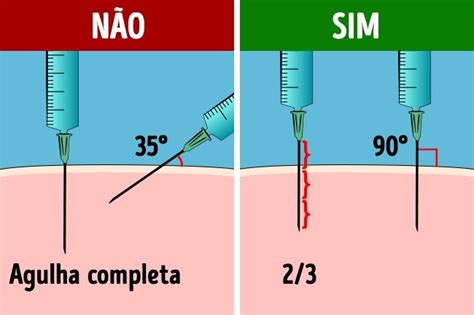 Como aplicar uma injeção corretamente