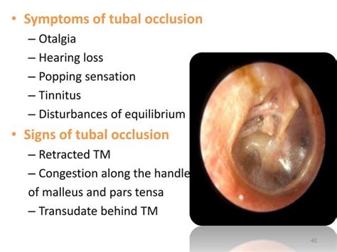 Anatomy and physiology of eustachian tube