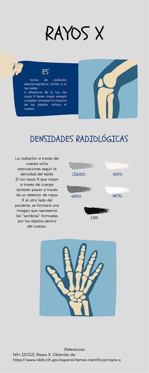 Rayos X infografía METAL RAYOS X forma de radiación electromagnética