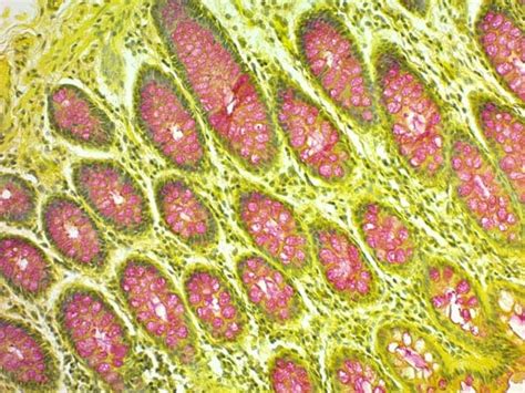 Mucicarmine Stain Kit (Mucin Stain) (ab150677) | Abcam