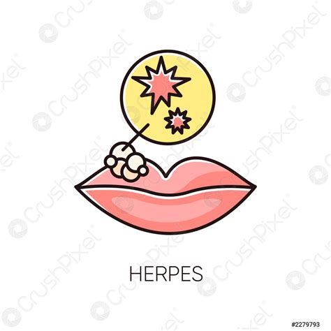 Herpes Rgb Color Icono Infección Viral De La Piel Vector De Stock 2279793 Crushpixel