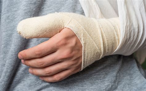 Athletes Can Return to Play in Half the Time with New Thumb Ligament Surgery | Cedars-Sinai