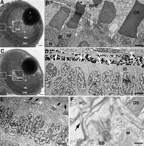 Disrupted Photoreceptor Os Formation In Kif Morphants A Wt Eye Of