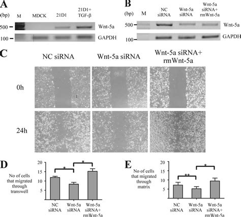 Sirna Silencing Of Wnt 5a Attenuates 21d1 Cell Migration And Invasion