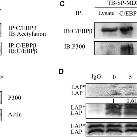 Il 6 Induced P300 Expression And Cebpβ Acetylation In Mdscs A