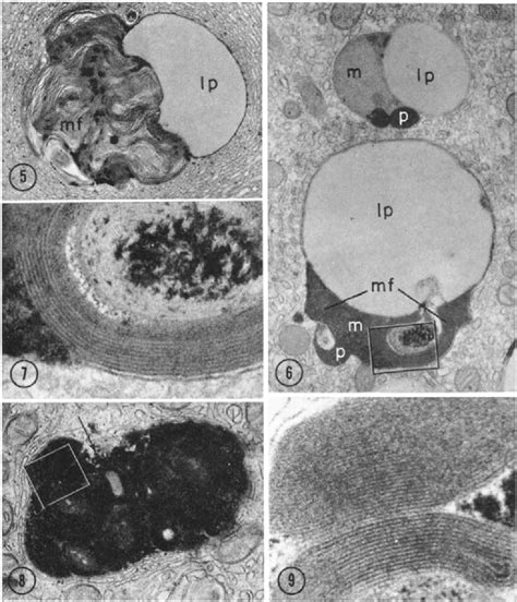 Figure 10 From Localization Of Acid Phosphatase In Lipofuscin Granules And Possible Autophagic