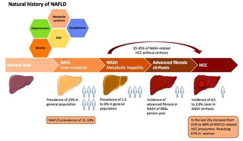 Hepatocellular Carcinoma On The Background Of Nonalcoholic Fatty Liver