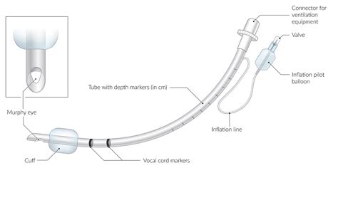 Endotracheal Intubation Equipment