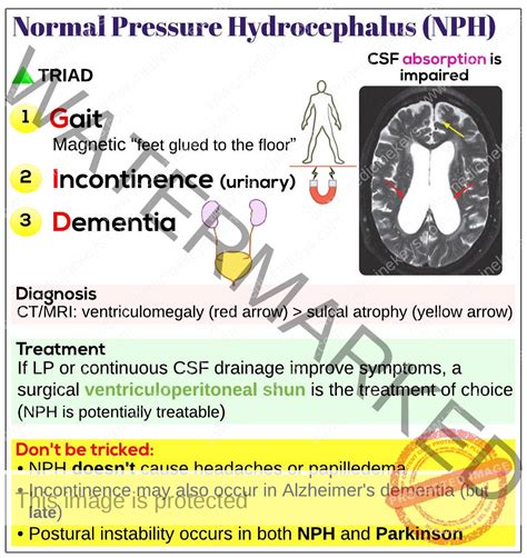 Normal Pressure Hydrocephalus Nph Medicine Keys For Mrcps