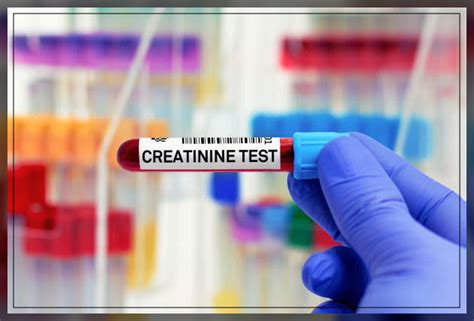 Creatinine Test Results Explained