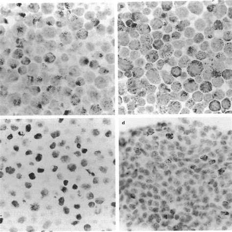 Immunohistochemical Staining Of Lymphokine Activated Killer LAK Cells