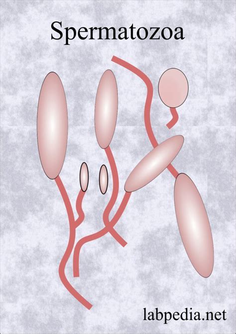 Intrauterine Insemination Iui Semen Preparation