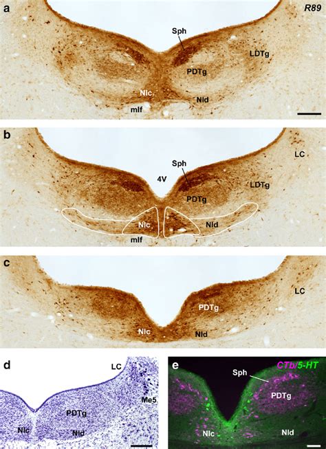 Fig Ure 11 Ac Brightfield Photomicrographs Illustrating Ctb Labeling