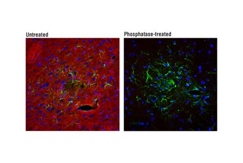 Phospho Tau Ser D Z G Rabbit Mab Cell Signaling Technology