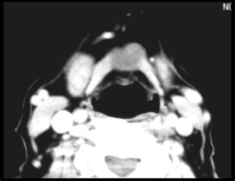 Question 23 MRI Online