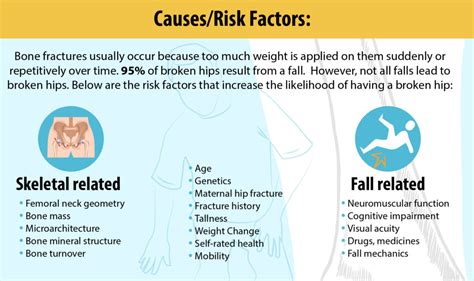 Broken Hip Types Causes And Symptoms Carelinx