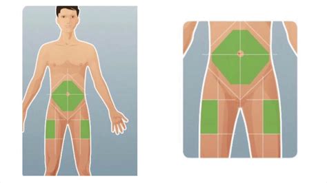 Ozempic Injection Sites Diagram