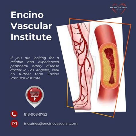 Peripheral Artery Disease Doctor In Los Angeles Welcome To Flickr