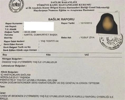 Adli Tıp Kurumundan 6 Yaşındaki Gelin İle İlgili Rapor Memurlarnet