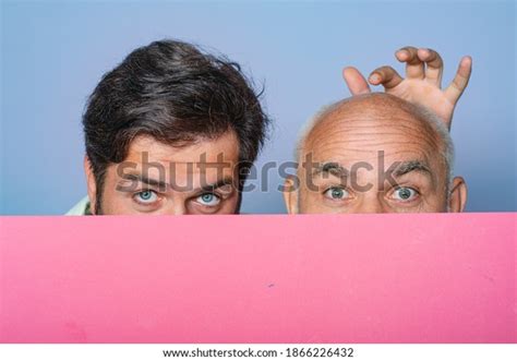 New Hair Transplant: Over 79 Royalty-Free Licensable Stock Photos | Shutterstock