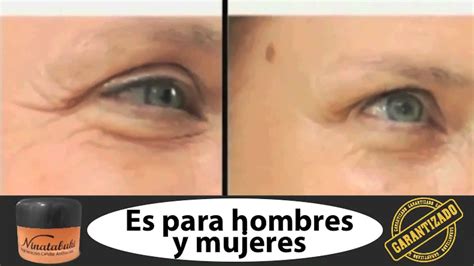 Crema Para Rejuvenecer Youtube