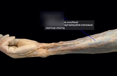 Cadaver Forearm Hand Lateral Diagram Quizlet