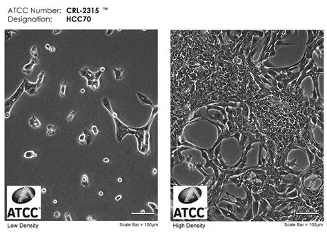 HCC70细胞ATCC CRL 2315细胞 人乳腺癌细胞株购买价格培养基培养条件细胞图片特征等基本信息 生物风