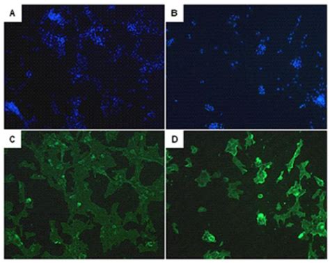 The Identification Of Pulmonary Arterial Smooth Muscle Cells Pasmcs