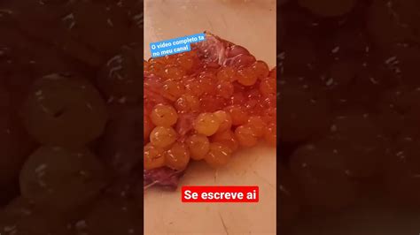 Ovas Do Peixe Bagre Viral YouTube