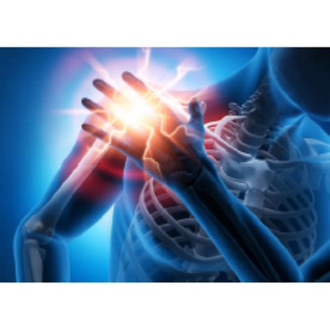 Subacromial Impingement Syndrome Hempstead Therapy Centre