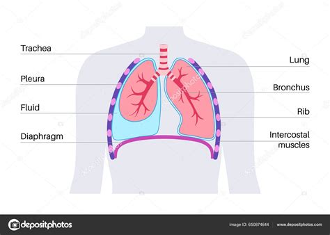 Enfermedad Derrame Pleural L Quido Entre Las Capas Tejido Los Pulmones