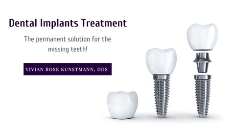 Dental Implants Dr Vivian Rose Kunstmann Dds Pa General Dentistry