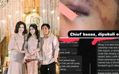 Dokter Koas Dipukuli Ibunda Lady Sempat Minta Video Penganiayaan Dihapus