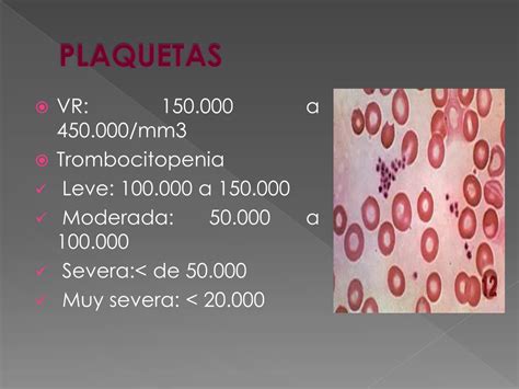 Ppt Interpretacion Del Hemograma En Pediatria Powerpoint Presentation