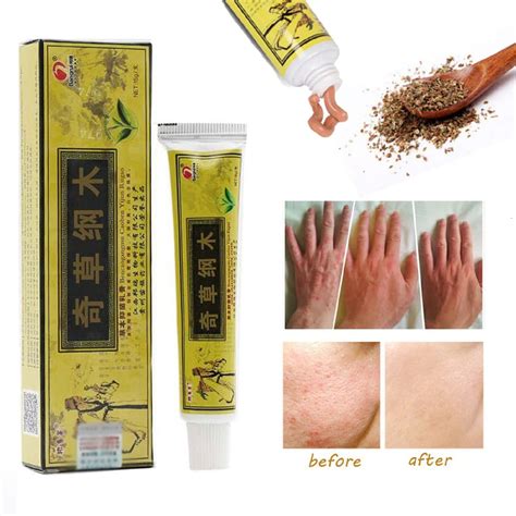 Pcs Lot Chinese Herbal Eczema Psoriasis Creams Dermatitis And Eczema