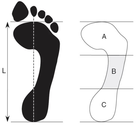 Arch Index Footprint With Reference Lines For Calculating The Arch