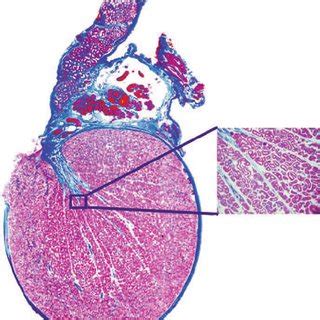 Human Testicle Cut In Half Telegraph