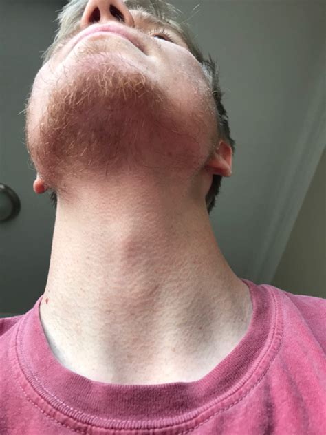 Y O Blonde Week Update Beard Board