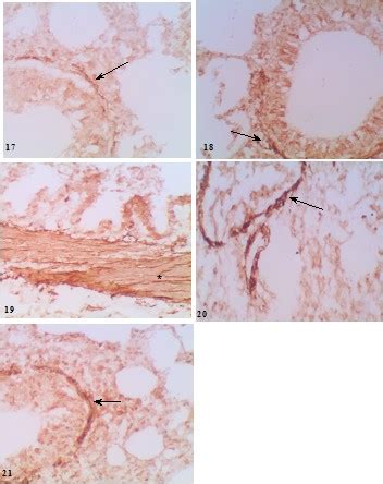 Photomicrograph Of Lung Section From Control Rat Showing Expression Of