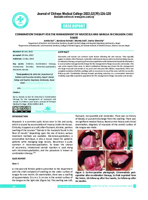 (PDF) Combination Therapy for the Management of Mucocele and Ranula in ...