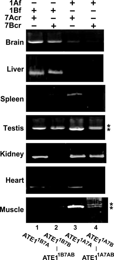 Expression Of Ate Mrna Isoforms In Mouse Tissues Rt Pcr Based