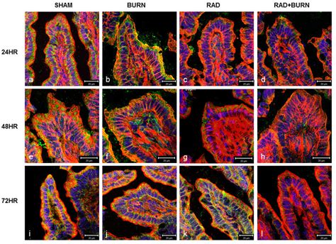 Cri Disrupts Tight Junction Protein Localization Sections Of Terminal