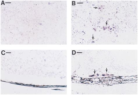 Immunohistochemical Analysis Of Viral Antigen Distribution Three Days